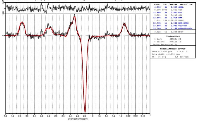 Snipaste_2026-02-25_09-13-40