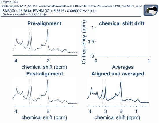 sub-210_ses-MRI1_voi-ACC_acq-pres_svs_Voxel_1_OspreyProcess_metab_A